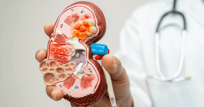 Does Creatine Cause Kidney Damage?