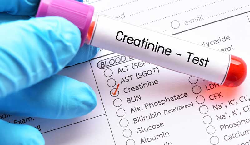 How Much Can Creatine Raise Creatinine Levels?